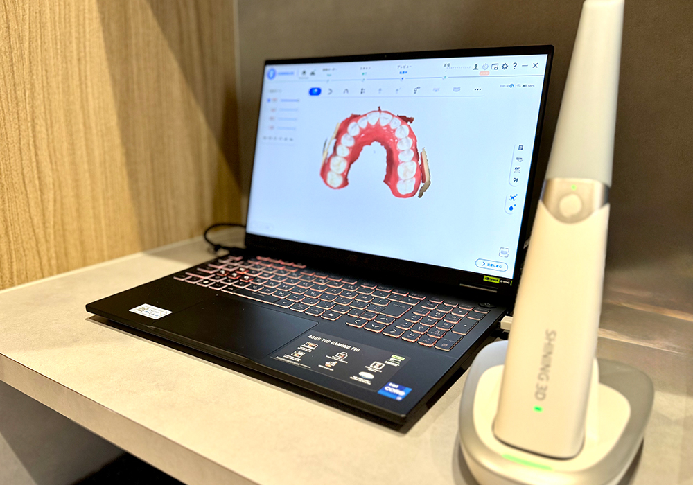 光学スキャナー