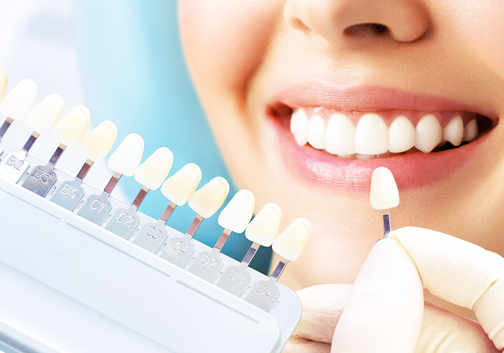 ホワイトニング